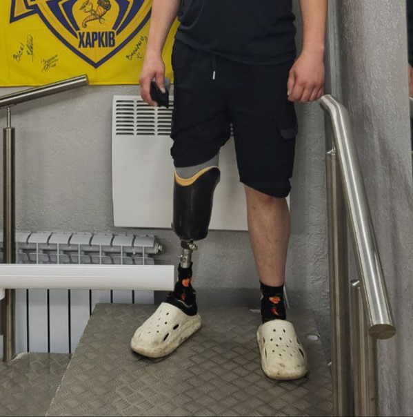 Як реагувати, коли бачиш людину з протезом?